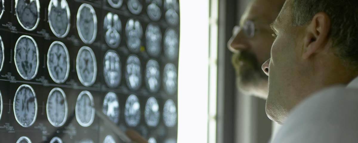 doctors reading brain scan